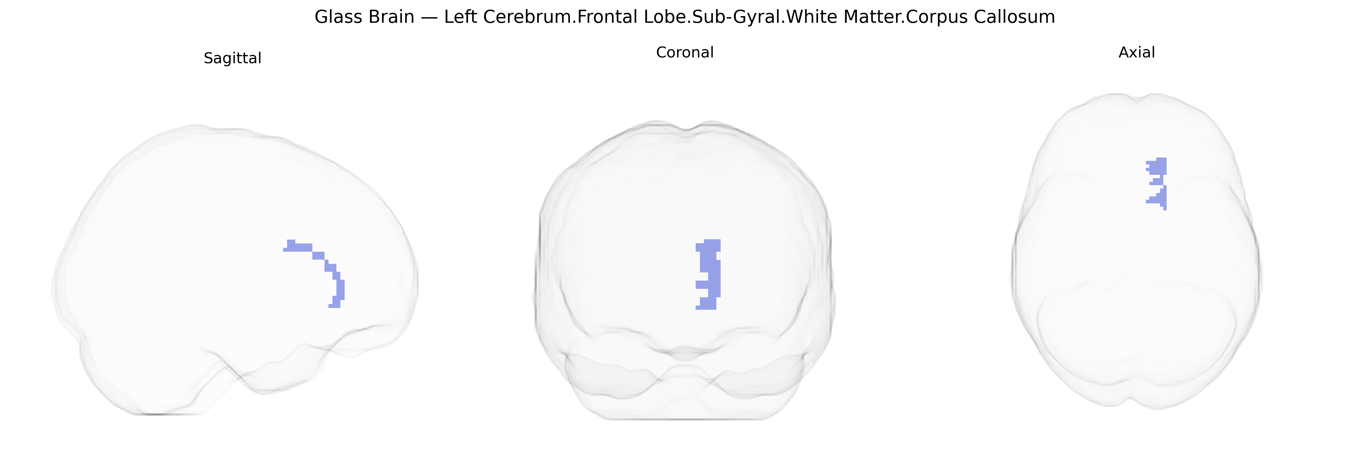 Triplanar Ghost Brain