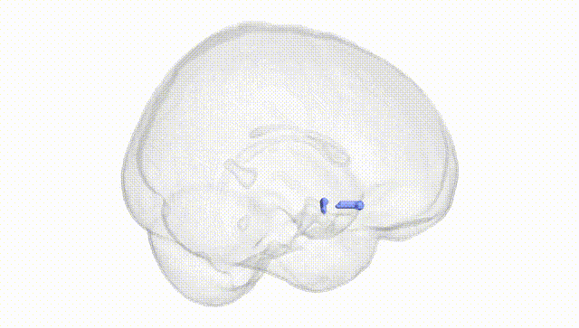Full Brain White