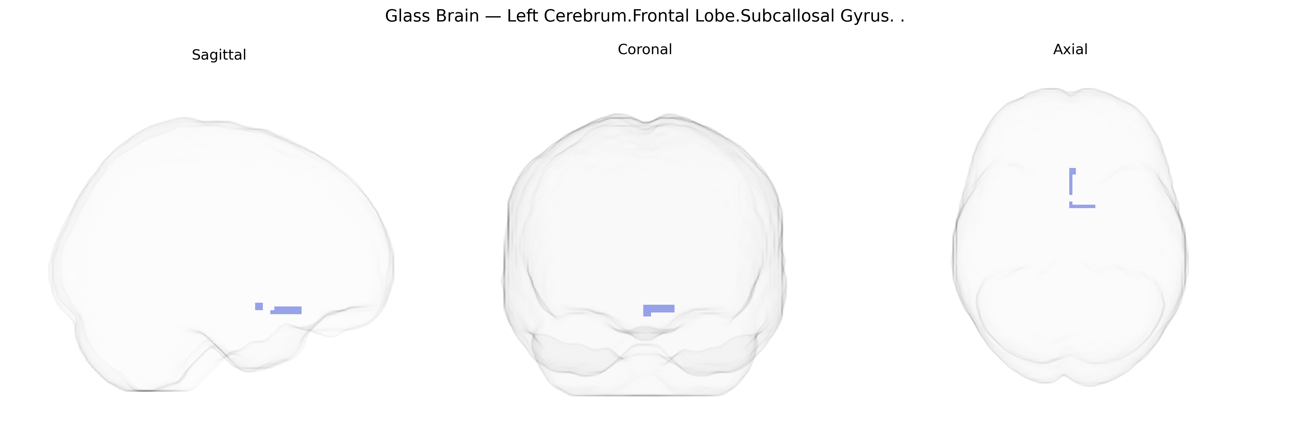 Triplanar Ghost Brain