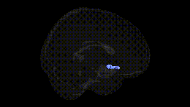 Full Brain Black