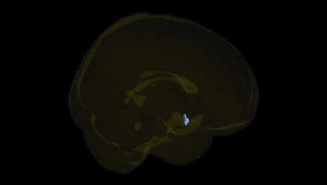 Full Brain Black