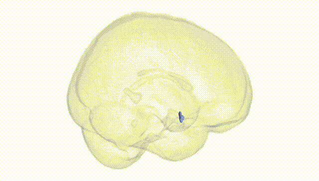 Full Brain White