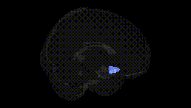 Full Brain Black