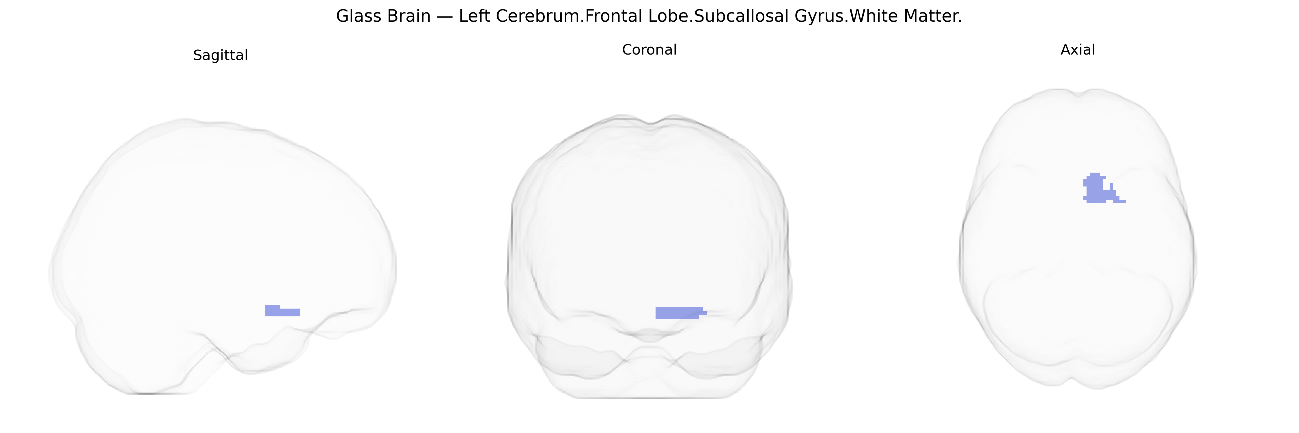 Triplanar Ghost Brain