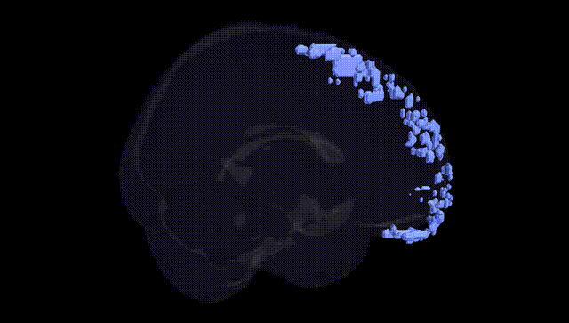 Full Brain Black