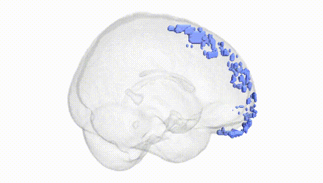 Full Brain White