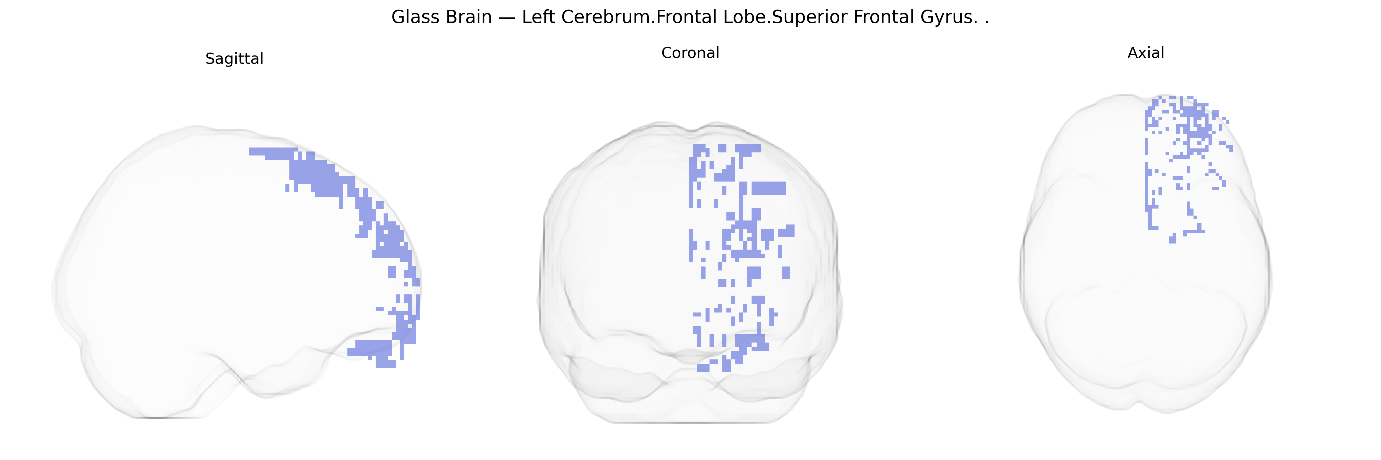 Triplanar Ghost Brain