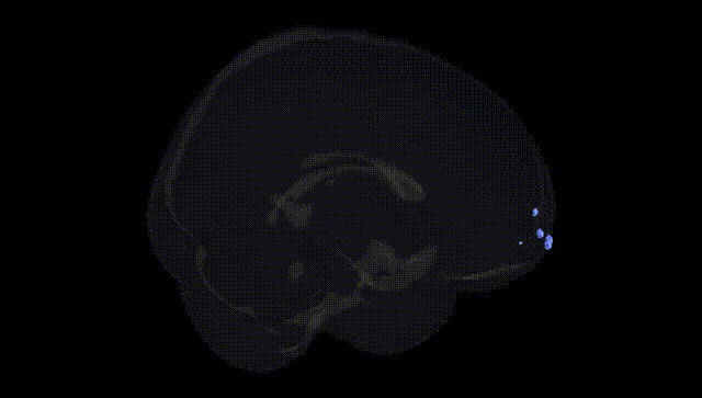 Full Brain Black
