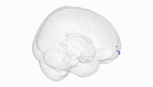Full Brain White