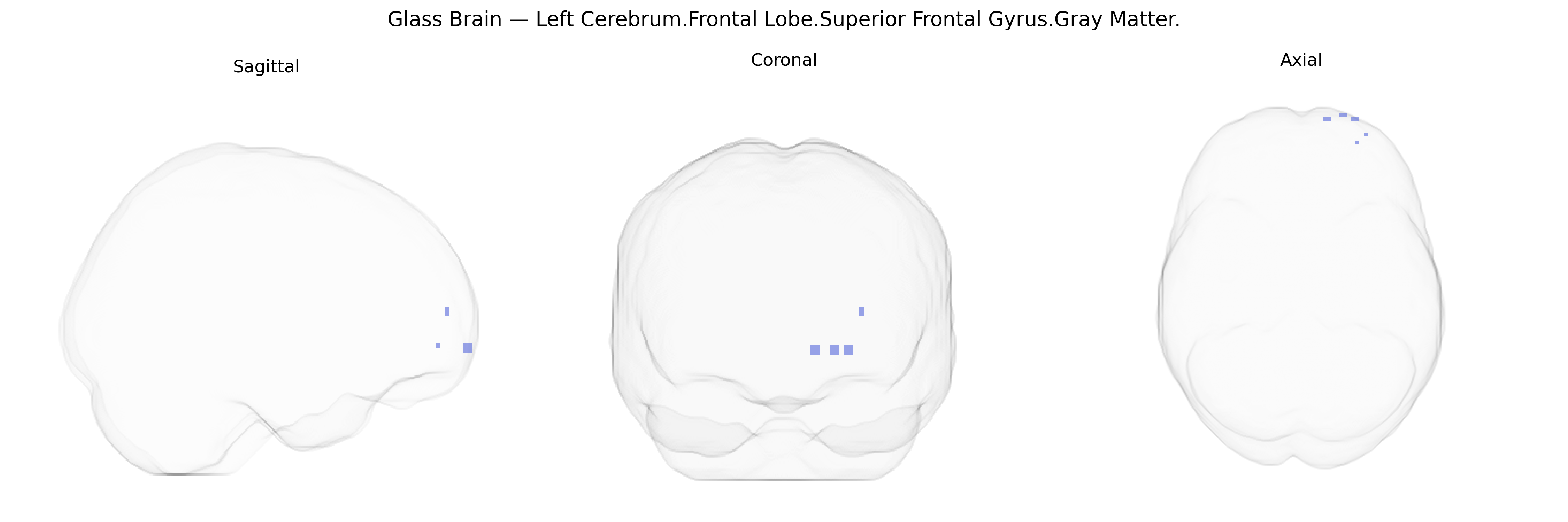 Triplanar Ghost Brain
