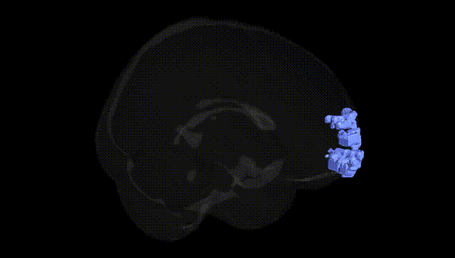 Full Brain Black