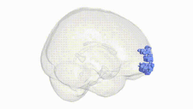 Full Brain White