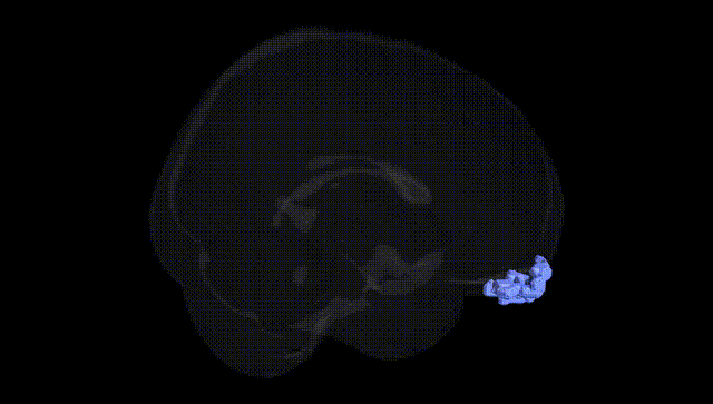 Full Brain Black