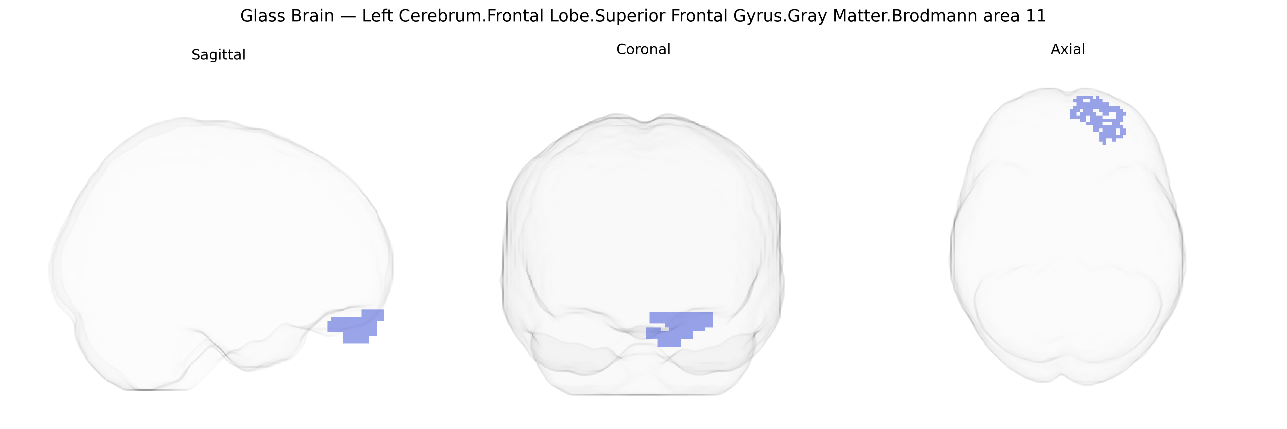 Triplanar Ghost Brain