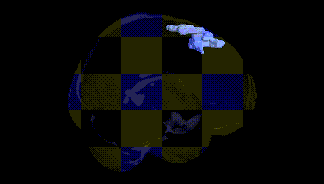 Full Brain Black