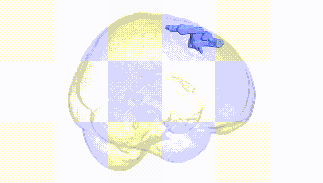 Full Brain White
