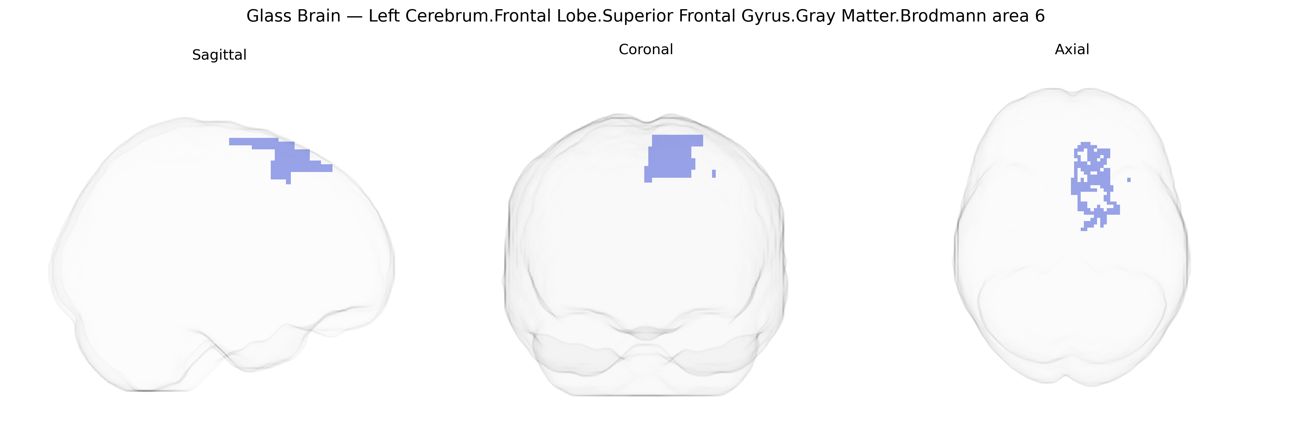 Triplanar Ghost Brain