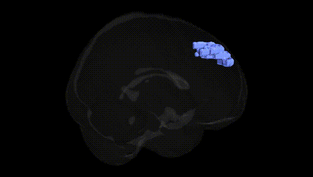 Full Brain Black