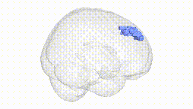 Full Brain White