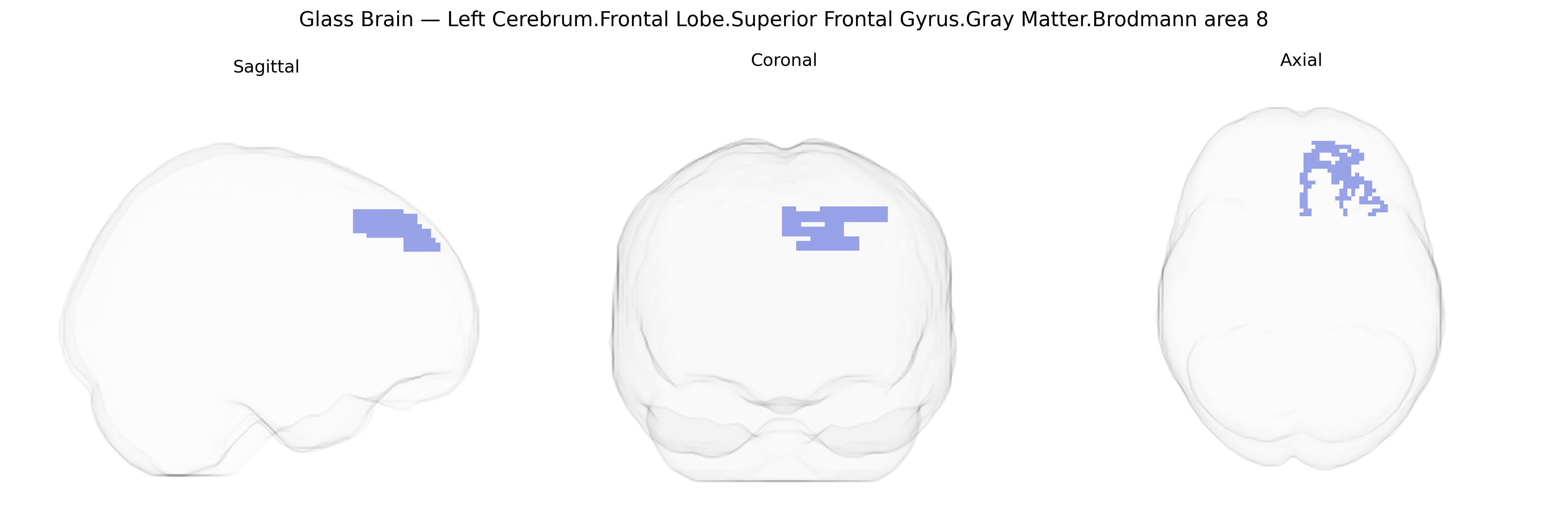Triplanar Ghost Brain