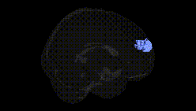 Full Brain Black