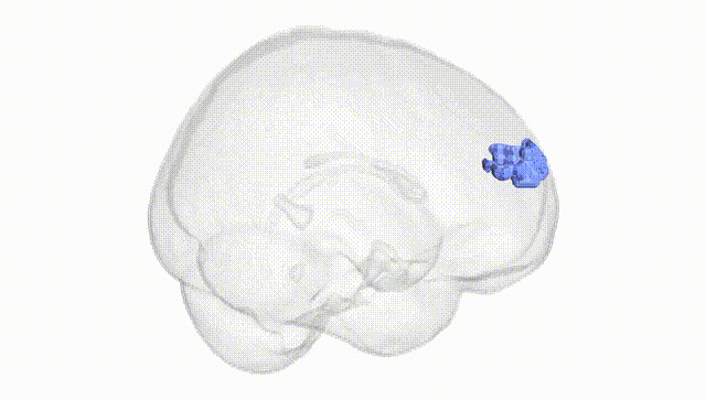 Full Brain White