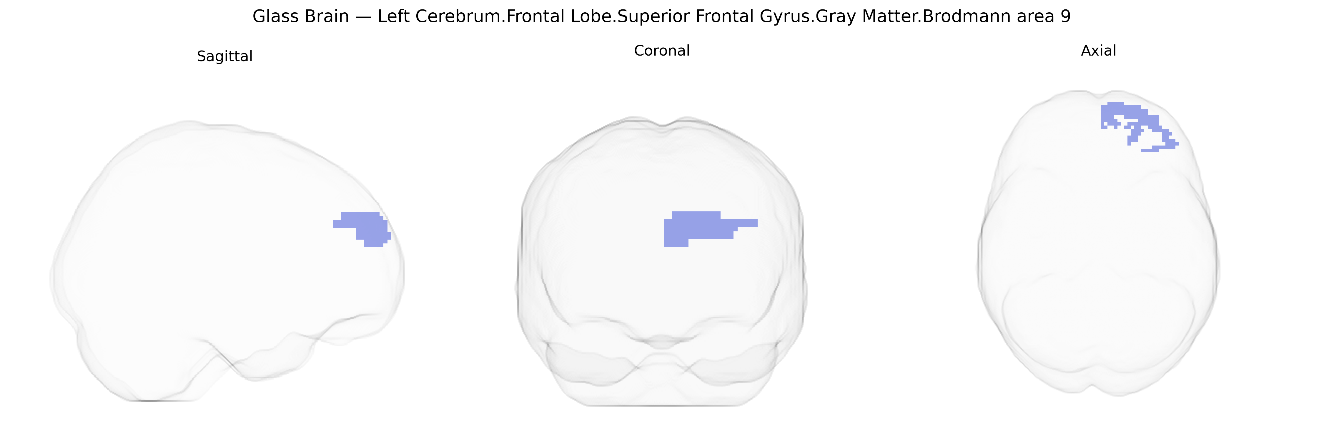 Triplanar Ghost Brain