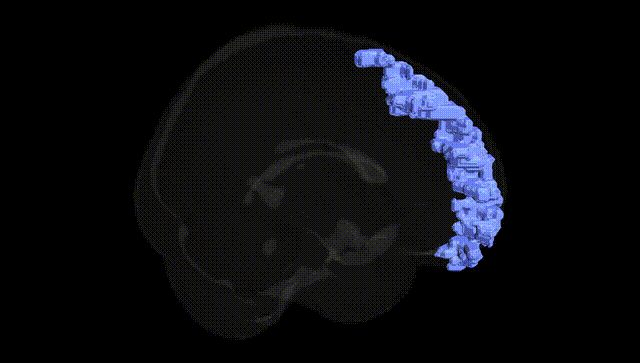 Full Brain Black