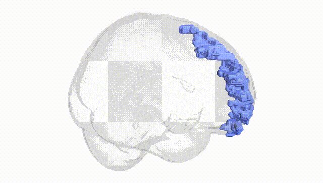 Full Brain White