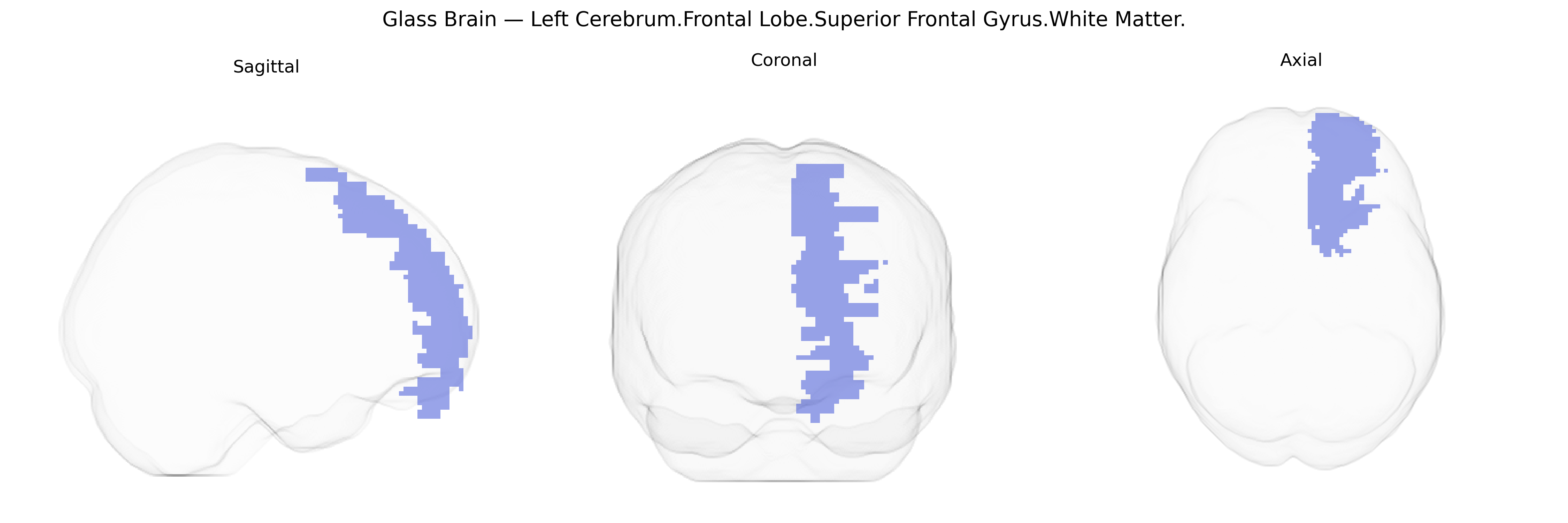 Triplanar Ghost Brain