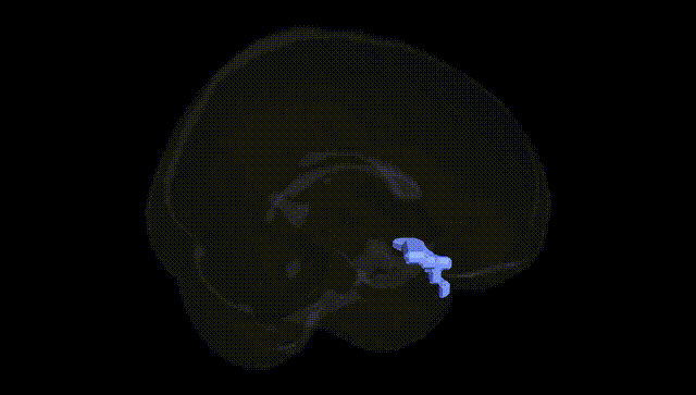 Full Brain Black