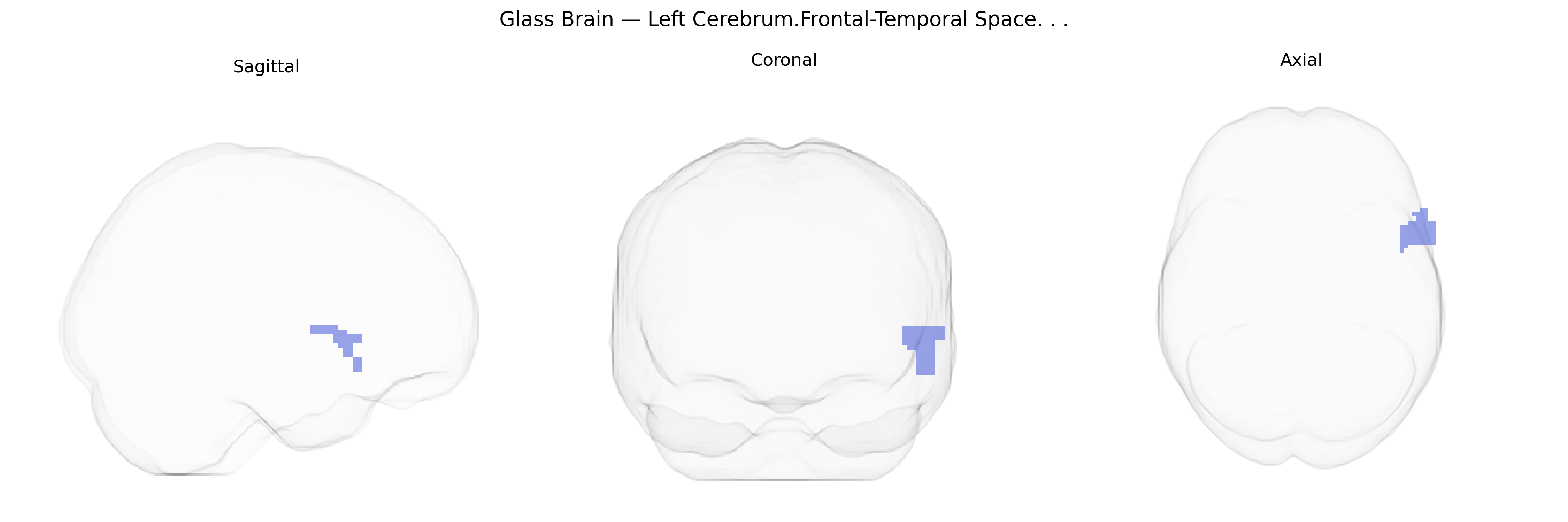 Triplanar Ghost Brain