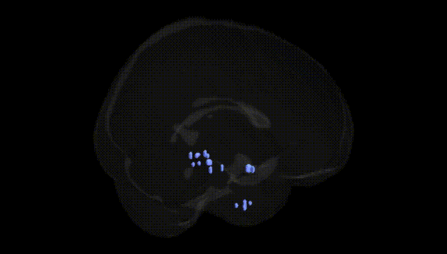 Full Brain Black