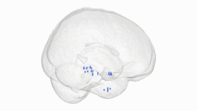 Full Brain White