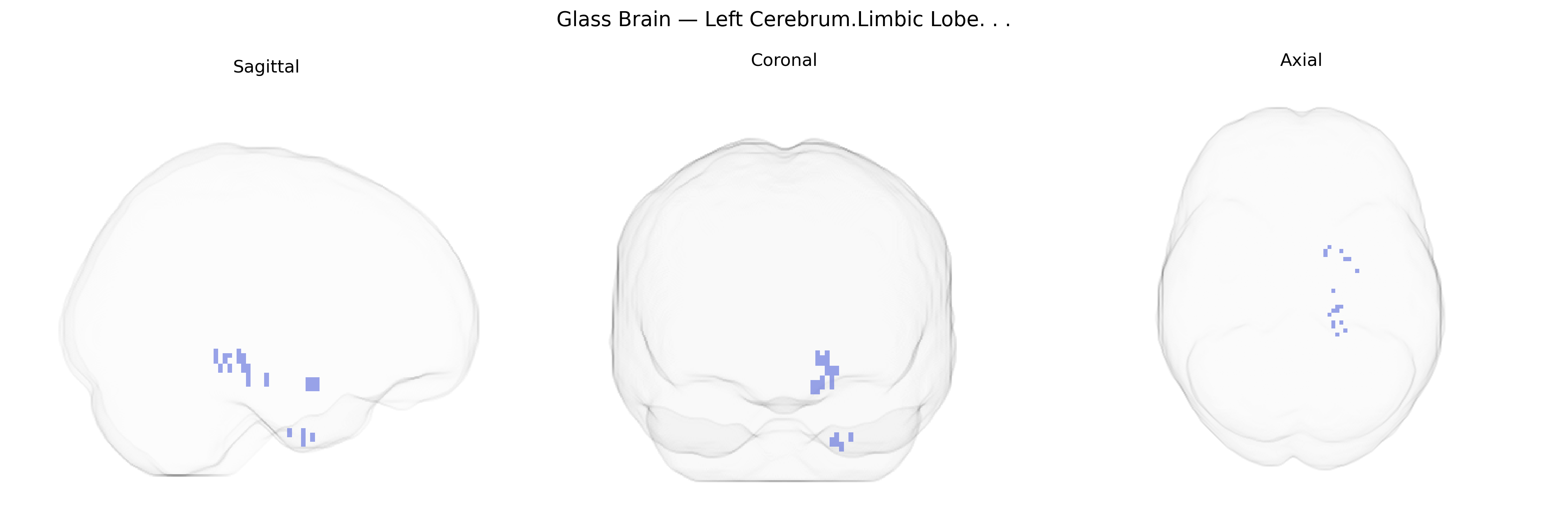 Triplanar Ghost Brain