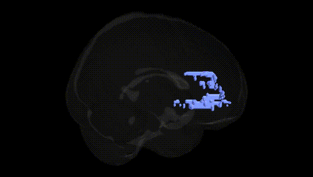 Full Brain Black