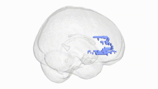 Full Brain White
