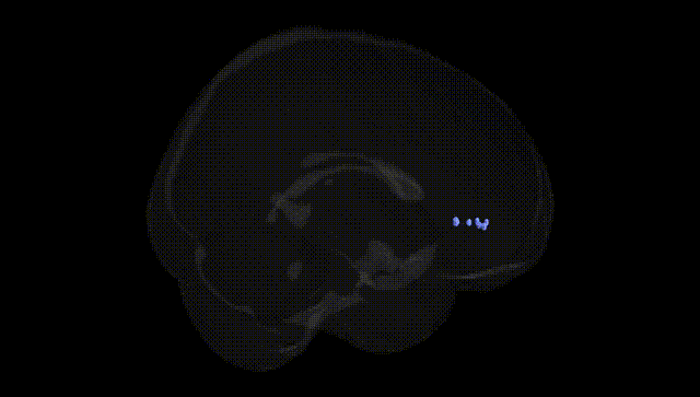 Full Brain Black