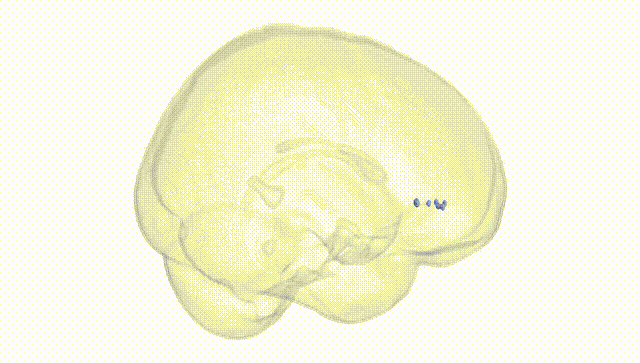Full Brain White
