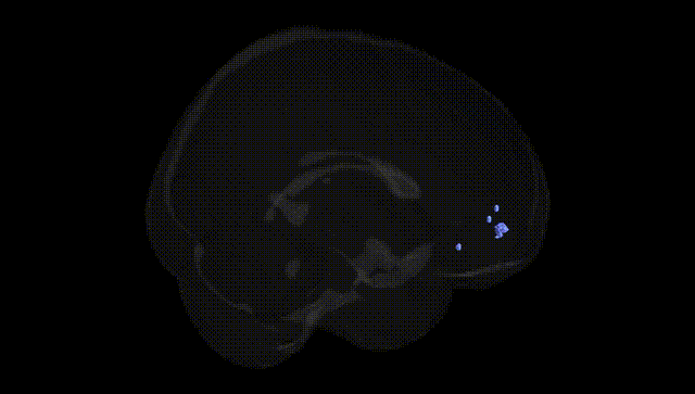 Full Brain Black