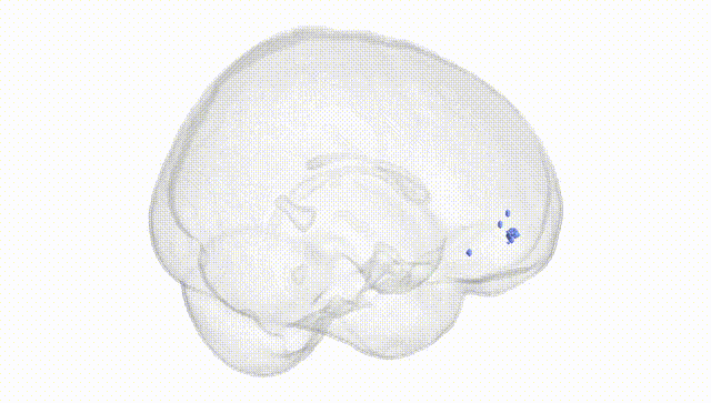 Full Brain White
