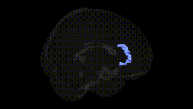 Full Brain Black