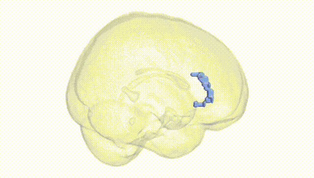 Full Brain White