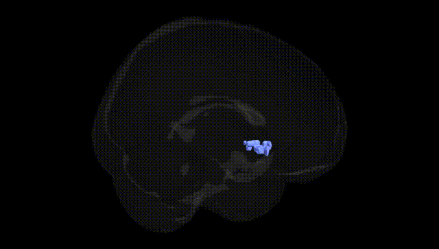 Full Brain Black