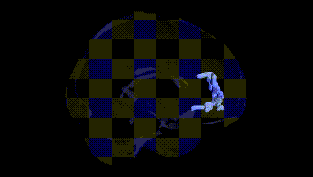 Full Brain Black