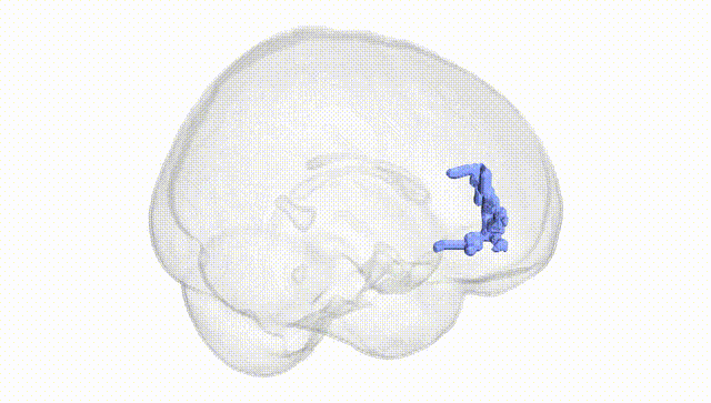 Full Brain White