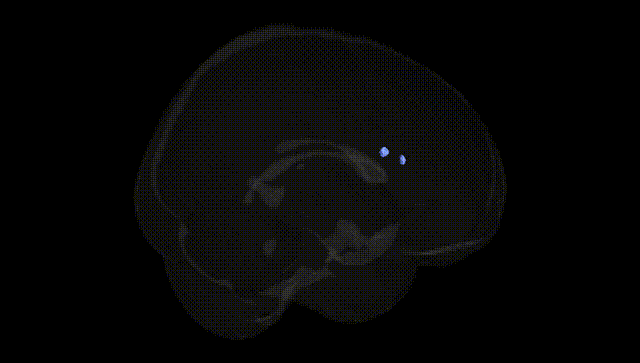 Full Brain Black