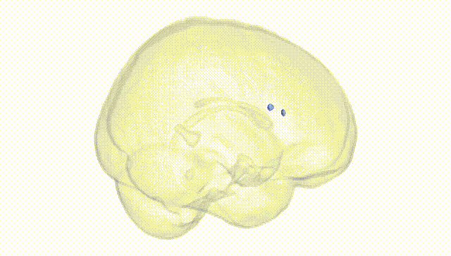 Full Brain White