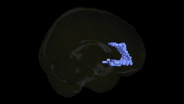 Full Brain Black