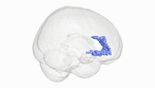 Full Brain White